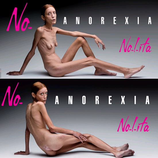 A imagem “http://readingpp.files.wordpress.com/2007/09/anorexia.JPG” contém erros e não pode ser exibida.